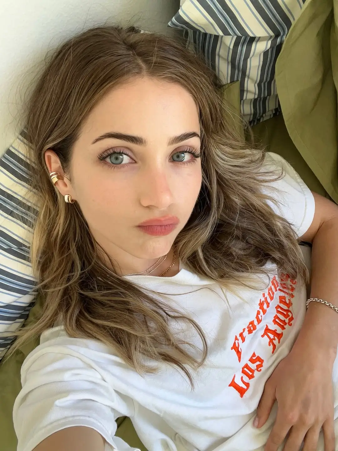 Mengenal Emily Rudd  Aktris di Balik Sosok Nami yang Ikonik dalam Live Action  One Piece 