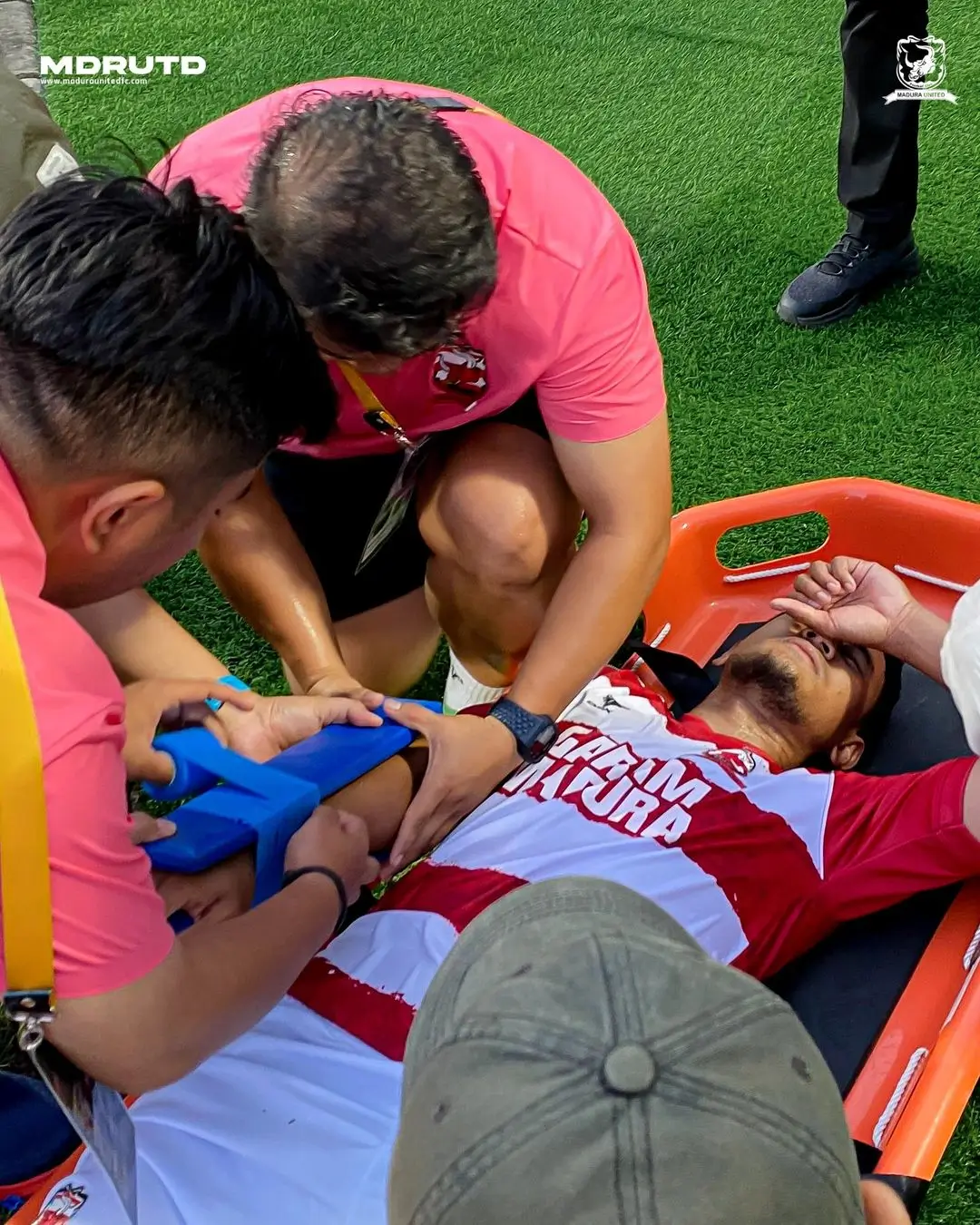 Bek Madura United, Haudi Abdillah menderita patah tangan di Piala Presiden 2024. Foto Instagram Madura United.