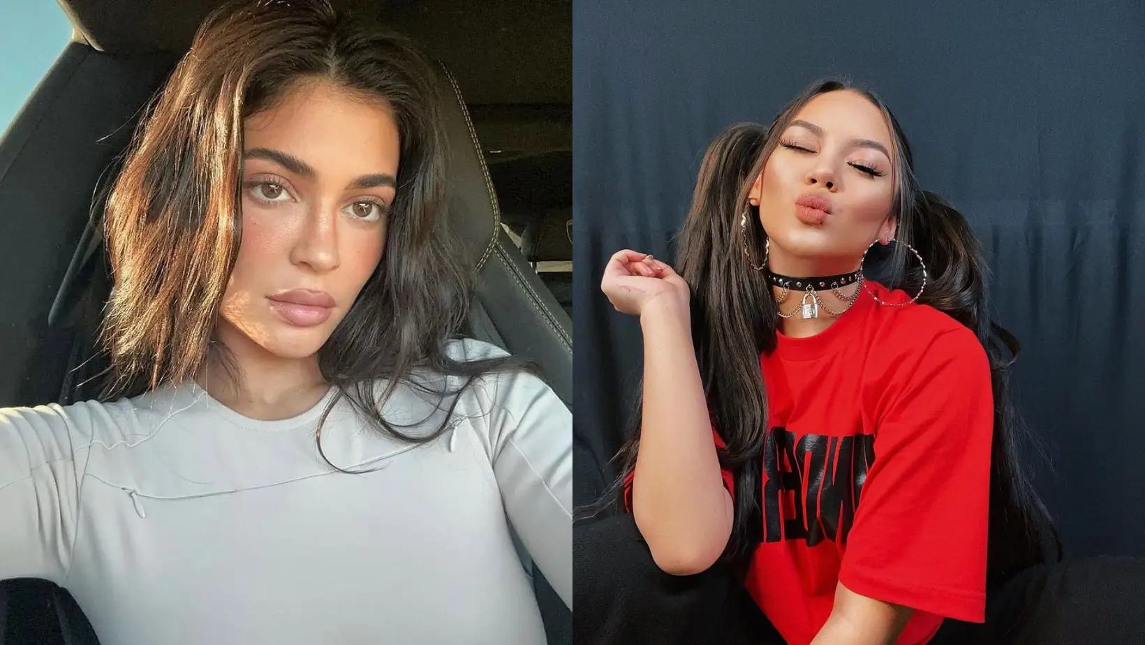 Jadi Favorit Artis  Yuk Kenali Manfaat dan Efek Samping Filler Bibir