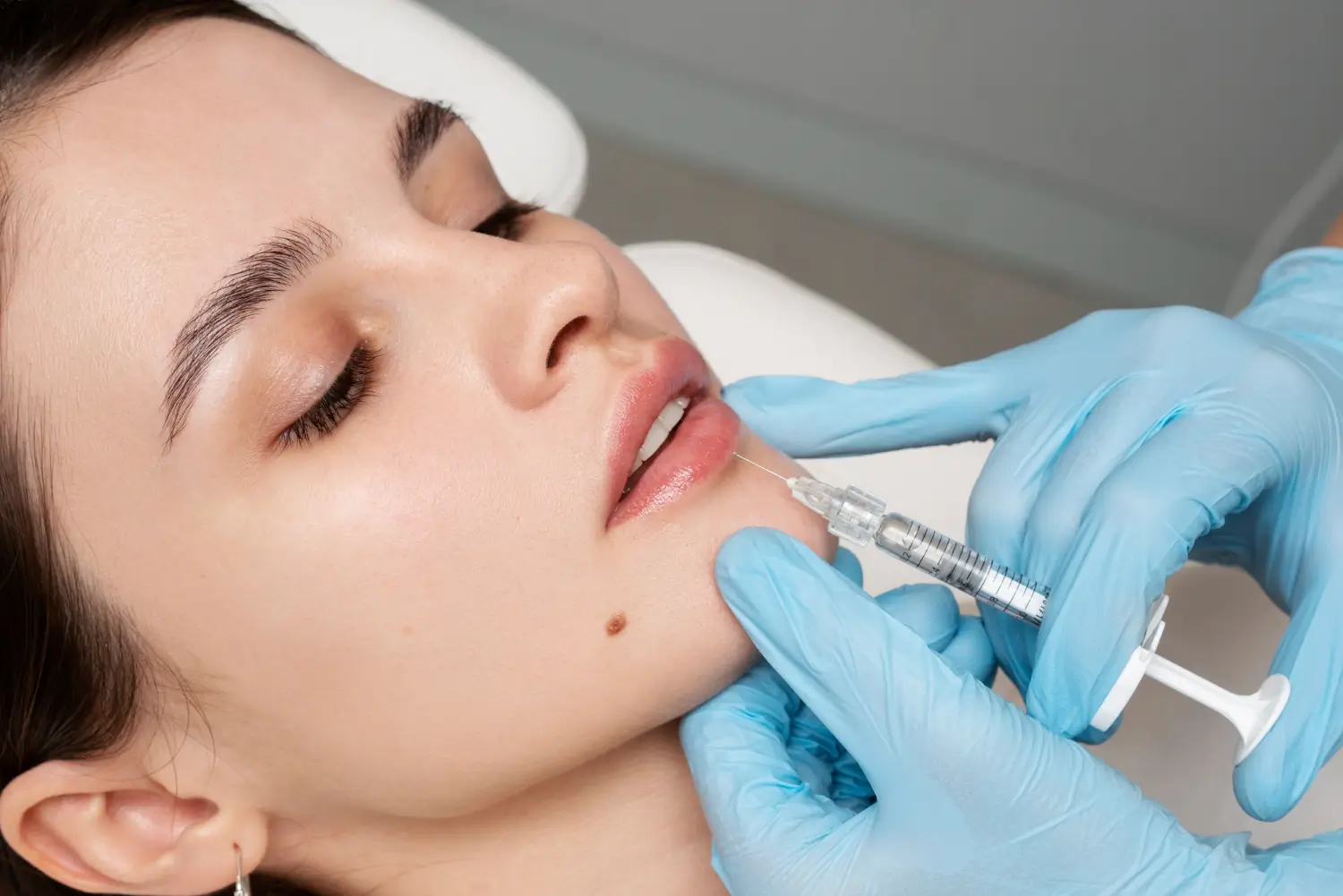 Foto: Ilustrasi Filler Bibir (freepik.com)