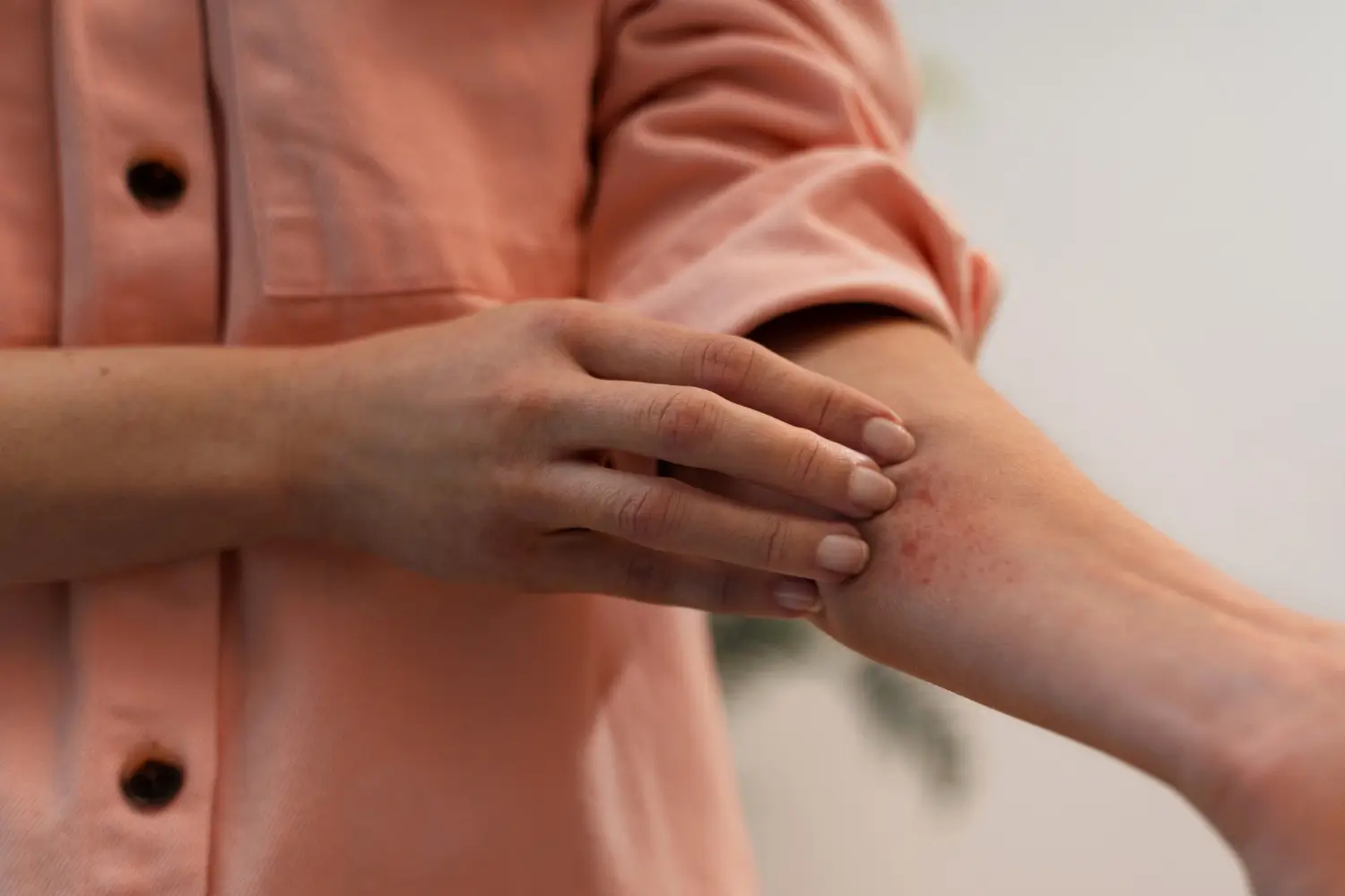 Foto: Ilustrasi Lyme Disease (freepik.com)
