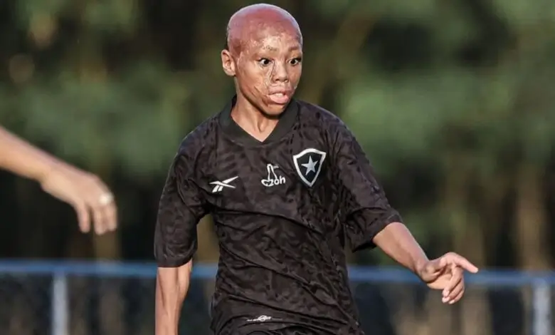 Bernardo Lopes menjadi simbol keteguhan dan harapan baru di dunia sepak bola Brasil. Foto Istimewa.