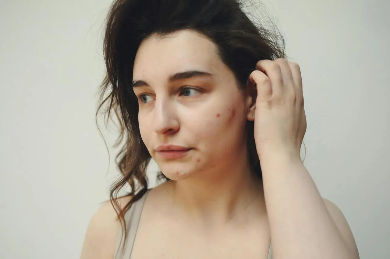 Foto: Pexels/Polina Tankilevitch